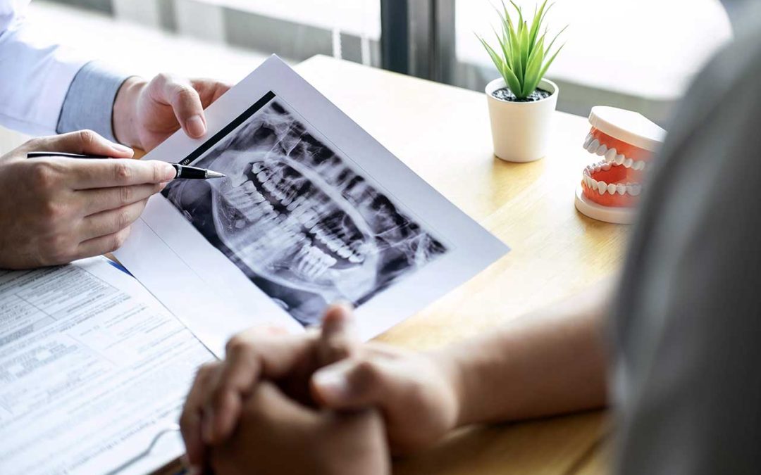 Periodontist showing tooth x-ray film and recommending treatment to his patient